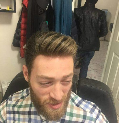 Protez Saç