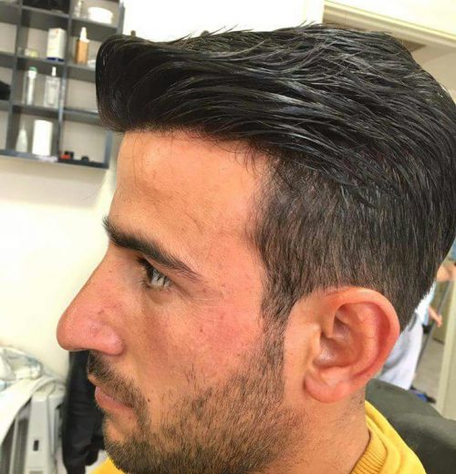 Protez Saç Protez Saç