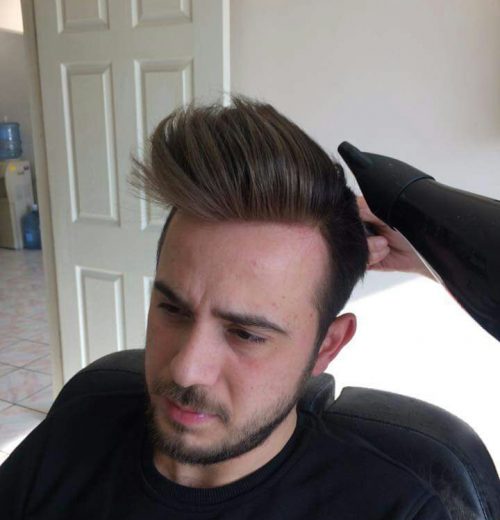 Protez Saç Protez Saç